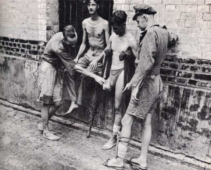 Four gaunt former prisoners against a brick wall; one sits with a crutch, others have bandaged or amputated limbs.